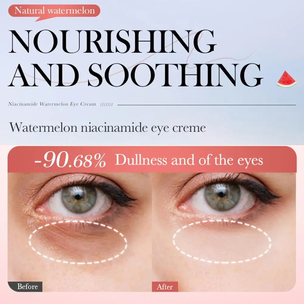Watermelon Niacinamide Facial Cleanser Essence Cream Toner Eye Cream Lip Balm Moisturizing Nourishing Skin Care