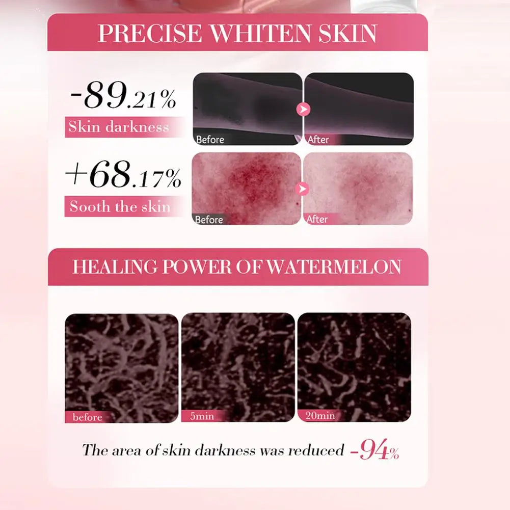 Watermelon Niacinamide Facial Cleanser Essence Cream Toner Eye Cream Lip Balm Moisturizing Nourishing Skin Care